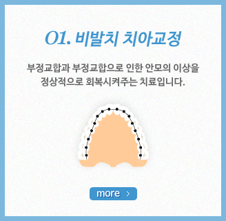 ���ġ ġ�� ����