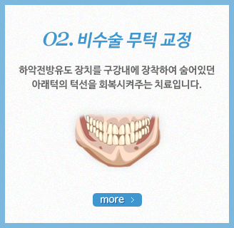 ����� ���� ����