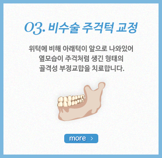 ����� �ְ��� ����