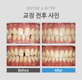 ���� ���� ����