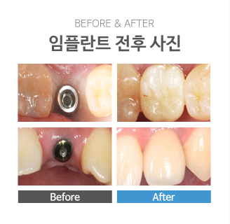 ���ö�Ʈ ���� ����